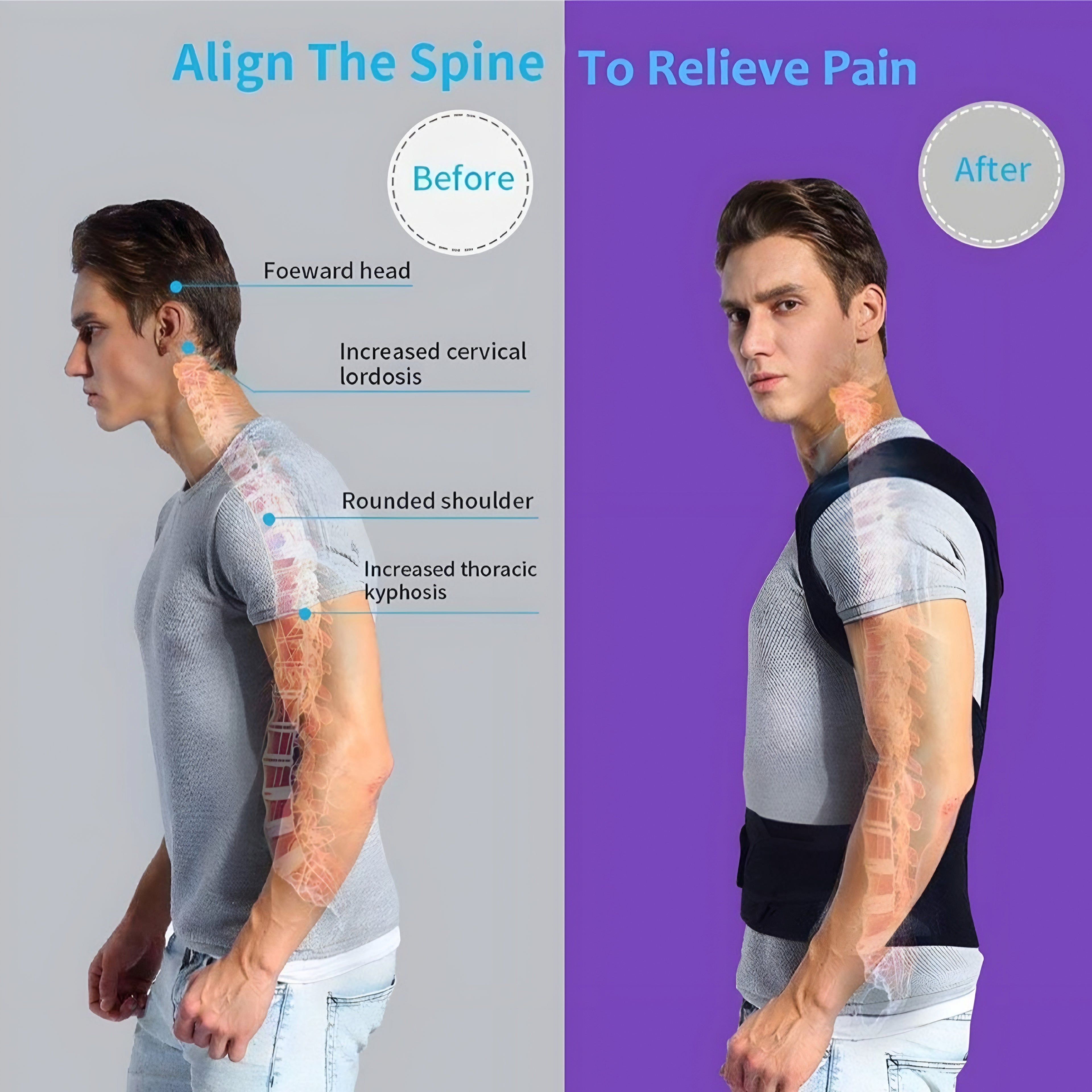CORELYN ALIGN™ Back Support Brace